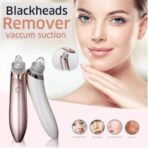 5in1 Rechargeable Black Head Remover Derma Vacuum Suction
