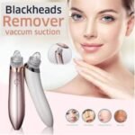 5in1 Rechargeable Black Head Remover Derma Vacuum Suction